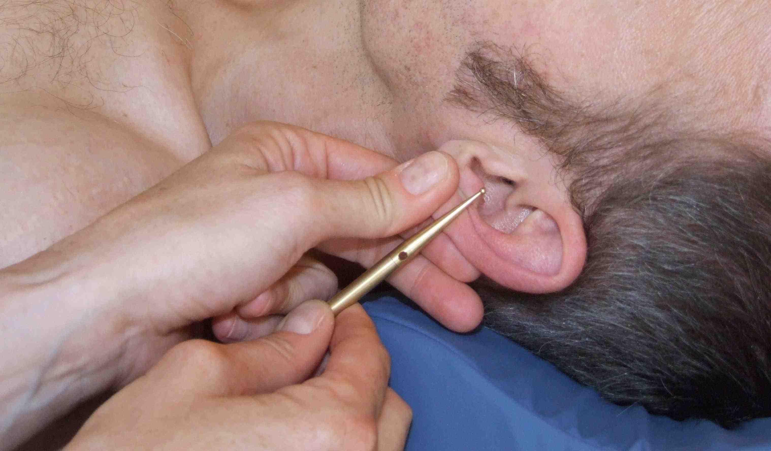 akupunktur-massage-apm-radloff-ohrbefund